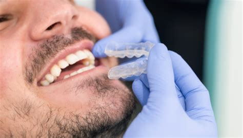 Ventajas De La Ortodoncia Invisible Invisalign Clinica En Madrid