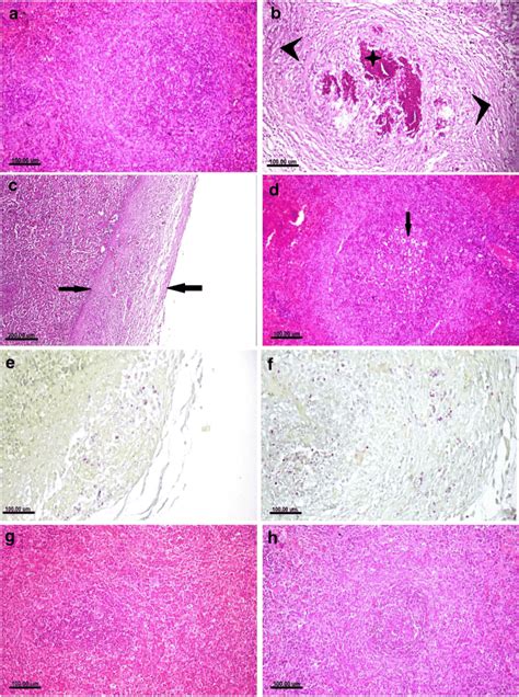 Photomicrograph Of Spleen Tissue Sections Of A Control Rat Showing Download Scientific