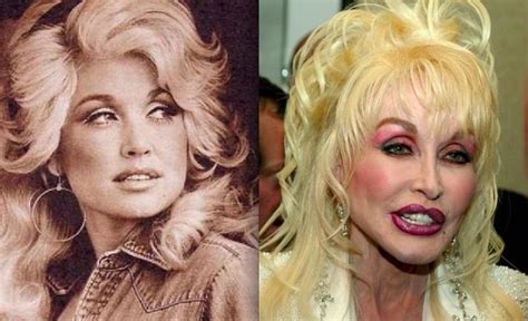 Epic Celebrity Plastic Surgery Fail You Didn't Know Of. - Vibes.NG