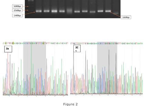 Figure 2 from Creating cell model of phenylketonuria disease by CRISPR-Cas9 mediated genome ...