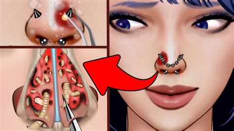 Asmr Nose Piercing Infection Treatment Nasal Cavity Cleaning Festering