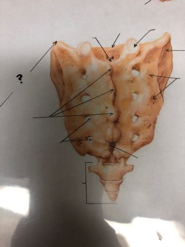 Sacrum And Coccyx Flashcards Quizlet