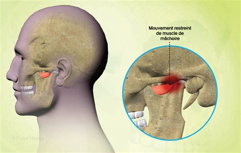 Health Condition Symptoms Causes Treatment And More