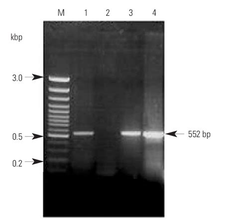 Ethidium Bromide Stained Agarose Gel Electrophoresis Of Polymerase