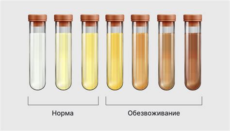 Изменения в моче - норма, причины, диагностика, лечение