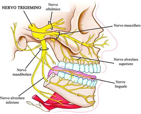 El nervio trigémino se origina a partir de tres núcleos sensoriales