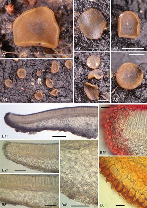 Macromorphology And Tissues In Section Of Orbilia Jesu Laurae A1 6