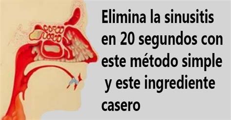 La Salud Ante Todo Elimina la sinusitis en 20 segundos con este método