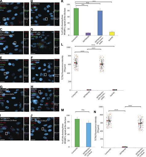 SEPTIN9 Exocyst And ARHGEF18 Mediate The Localization Of Transition