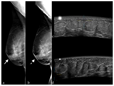 Diagnostics Free Full Text Associating Automated Breast Ultrasound