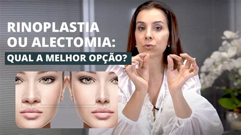 Rinoplastia X Alectomia Qual A Melhor Op O Youtube