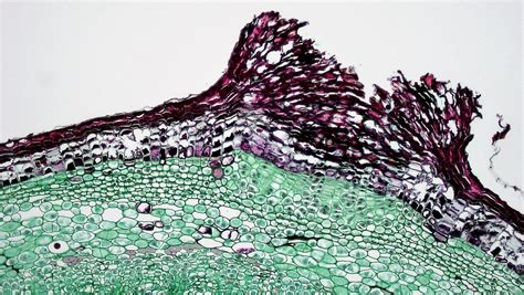 Woody Dicot Stem Lenticel Development In Sambucus Flickr