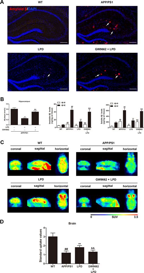 Lpd Treatment Reduced A Plaques And Increased Brain Glucose Uptake In