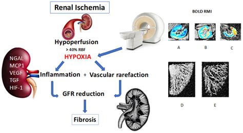 Ijms Free Full Text Stem Cells In Kidney Ischemia From