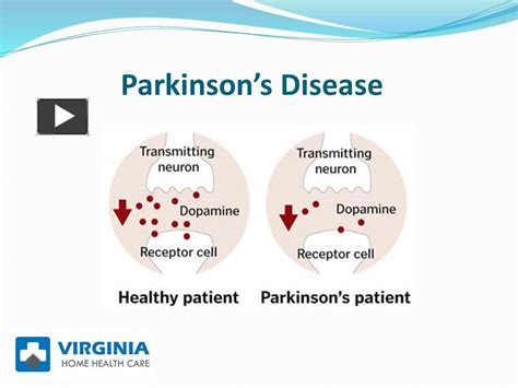 Ppt Symptoms Of Parkinsons Powerpoint Presentation Free To Download Id 996229 Mwe0z