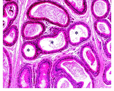 Photomicrograph Of A Section Of Cauda Epididymis Of A Rat From Group 1