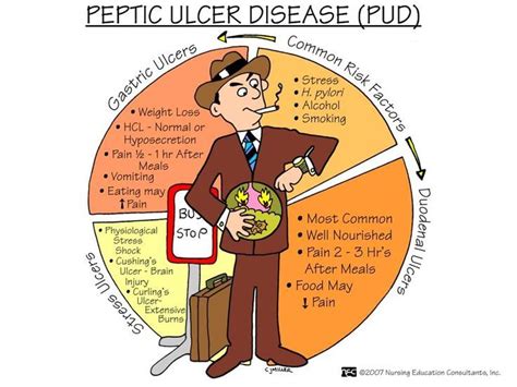 Abc Medicine Peptic Ulcer Disease Pud Nclex Prep And Study Resources