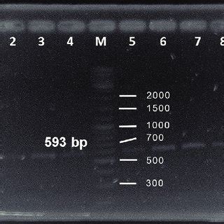 Polymerase Chain Reaction Pcr Products Agarose Gel