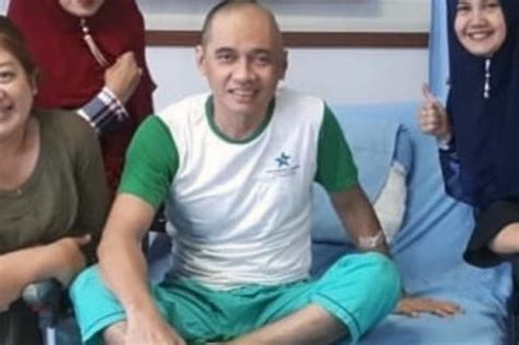 Komedian Agung Hercules Tutup Usia Akibat Kanker Otak Kesehatan