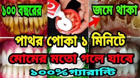 ১০০ বছরের জমে থাকা পাথর পোকা ১ মিনিটে মোমের মতো গলে যাবে ১০০