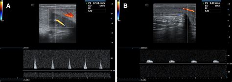 Longitudinal Images Acquired During Penile Colour Doppler Download