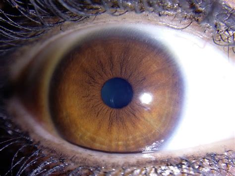 17 Best images about Iris patterns / Iridology on Pinterest | What's the, Colors and Eyes