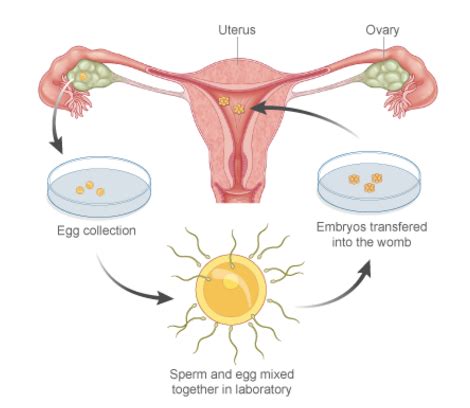 Ivf Test Tube Baby Ivf Treatment Cycle Risks And Sucess Rates