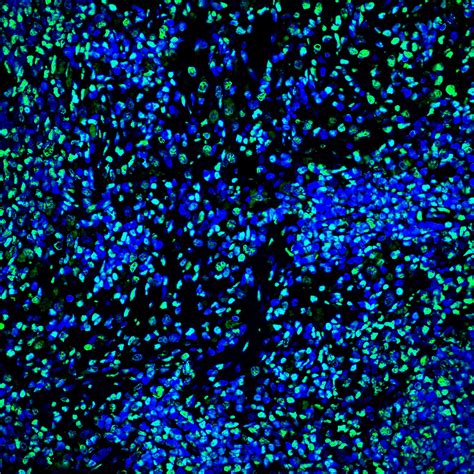 科研用 One step TUNEL In Situ Apoptosis Kit Green FITC Elabscience 官方网站