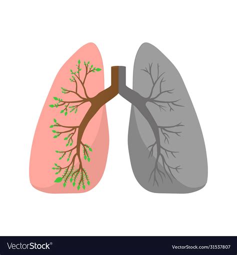 Free Lung Cancer Clipart