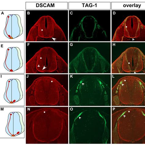 Dscam Protein Is Expressed By Commissural Axons In The Developing Rat