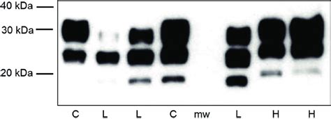 Western Blotting Analysis Of Prpsc From Classical And Atypical Bse