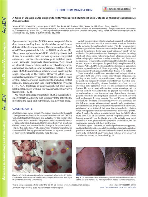 Pdf A Case Of Aplasia Cutis Congenita With Widespread Multifocal Skin Defects Without