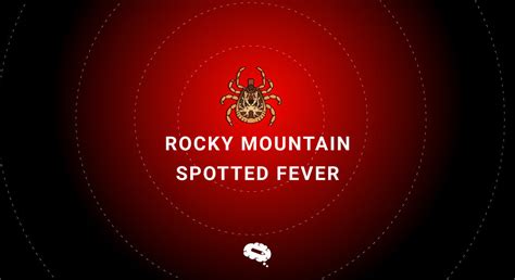 Rocky Mountain Spotted Fever: Symptoms, Treatment, and Prevention ...