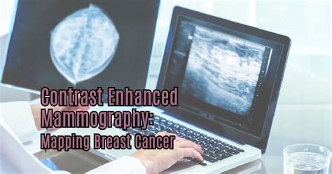 Contrast Enhanced Mammography: Mapping Breast Cancer