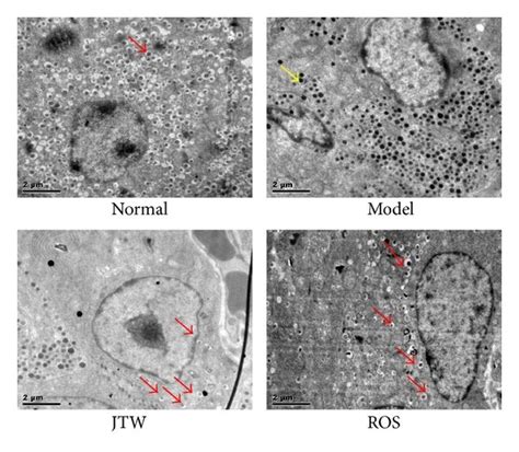 Jtw Ameliorates Islet Morphology In Pancreas And β Cell Function A