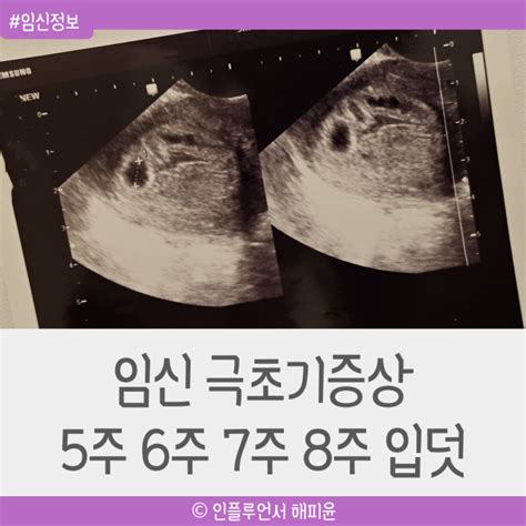 임신 극초기증상 5주차 6주차 7주차 8주차 입덧 네이버 블로그