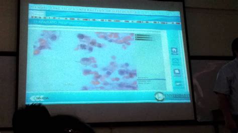 Visualizaci N Cd De Histo Sistema Respiratorio Parte Ii Youtube