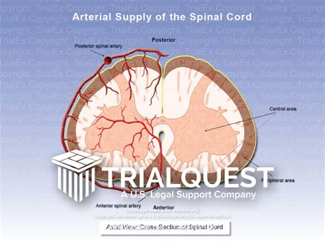 Arterial Supply Of The Spinal Cord Trialexhibits Inc