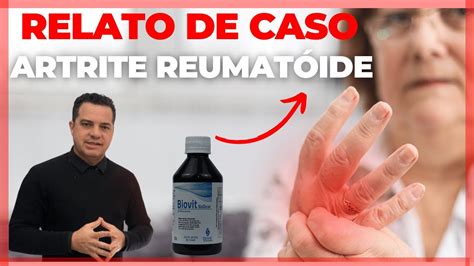 Sucesso Na Artrite Reumat Ide O Uso Do Biovit Youtube