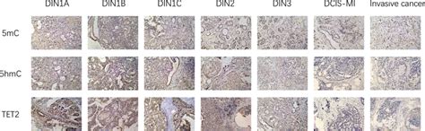 Examples of 5mC, 5hmC, and TET2 expressions. The 5mC, 5hmC, and TET2 ...