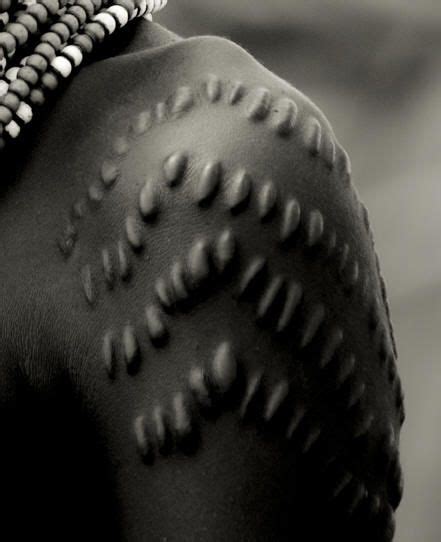 Zygoma The Scarred Arm Of A Female Tribe Member Scarification