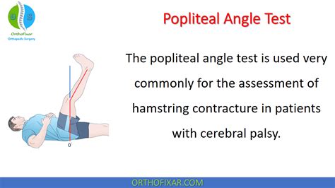 Popliteal Angle Test Easy Explained Orthofixar 2024 Angle Test