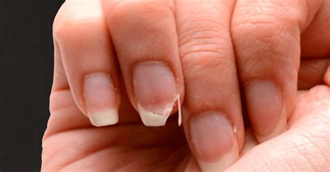 Comment Durcir Les Ongles Sans Ail Recettes Infaillibles Jardin