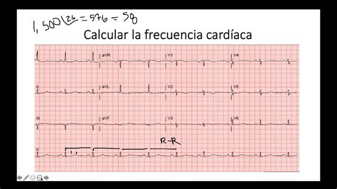 Como Calcular Frequencia Cardiaca Ictedu