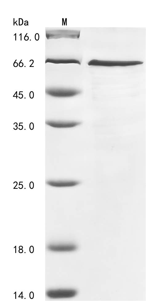 Recombinant Human Ras Gtpase Activating Protein Binding Protein 1