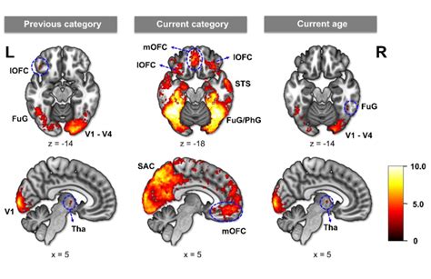 Results From The Whole Brain Multi Voxel Pattern Analysis MVPA