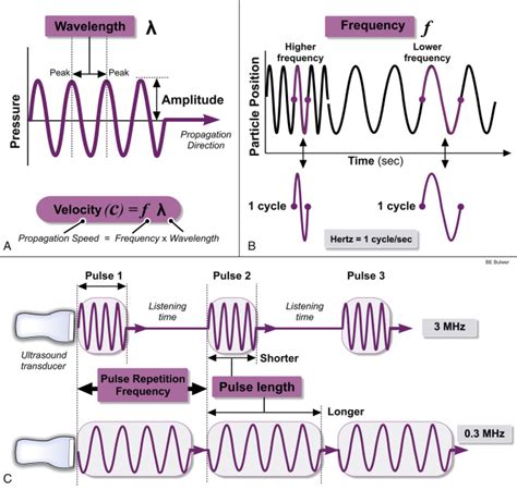 Physical Principles Of Ultrasound And Generation Of Images Thoracic Key