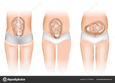 Embarazo Diferentes Posiciones Del Bebé Útero Posiciones Del Feto Útero