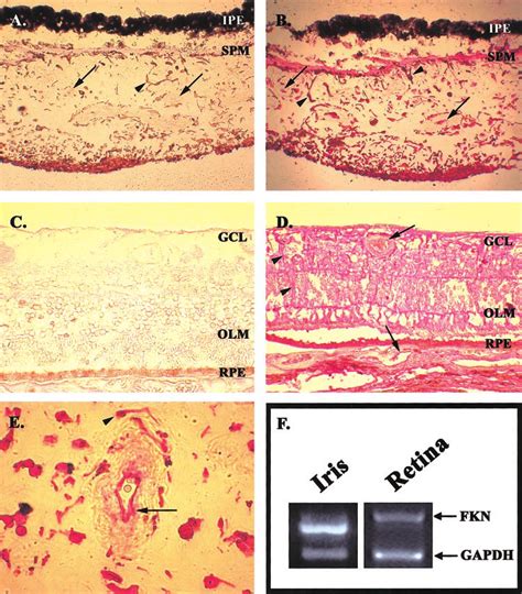 Immunohistochemical Analysis Of Fkn Protein Expression In Human Iris