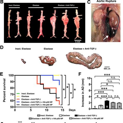 Nf κb Activation In Elastase Induced Aaa Download Scientific Diagram